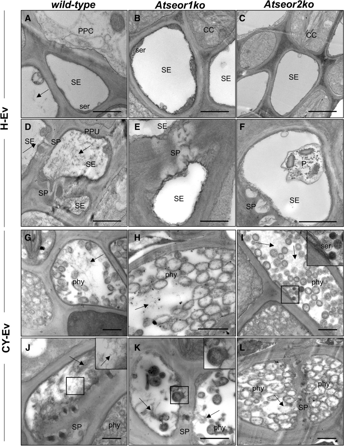 Pre-symptomatic modified phytohormone profile is associated with lower  phytoplasma titres in an Arabidopsis seor1ko line | Scientific Reports