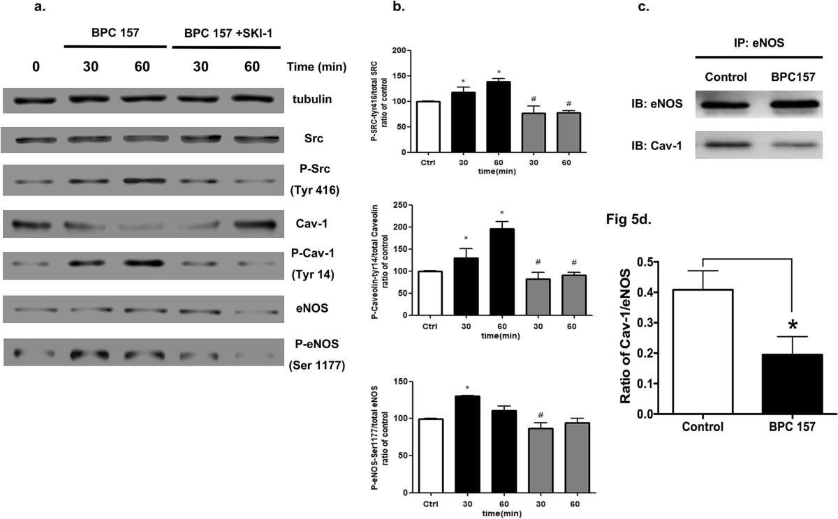 bpc-157 counters oxidative stress Modulatory effects of BPC 157 on vasomotor tone and the activation of Src-Caveolin-1-endothelial nitric oxide synthase pathway