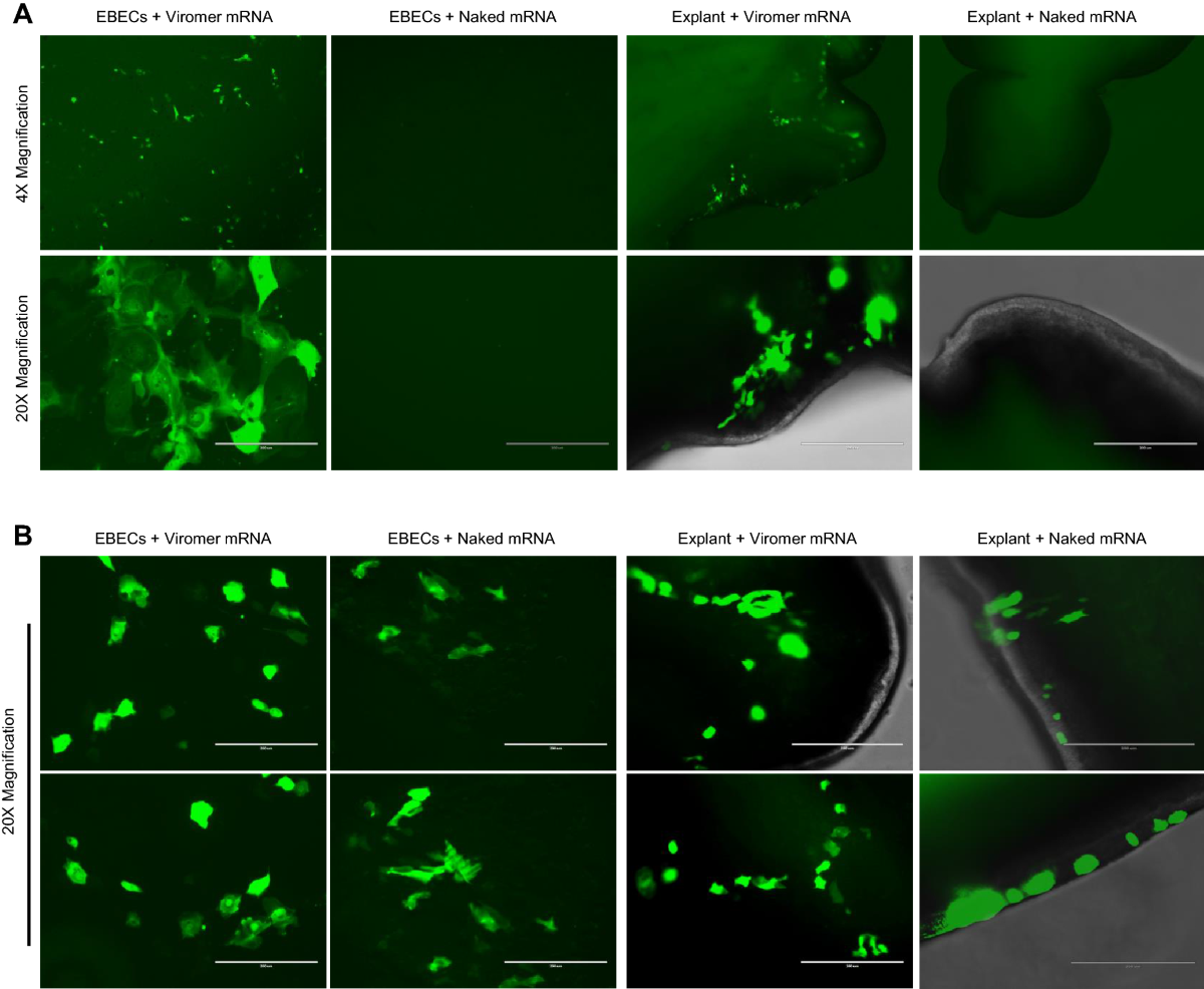 Safe and effective aerosolization of in vitro transcribed mRNA to the  respiratory tract epithelium of horses without a transfection agent |  Scientific Reports