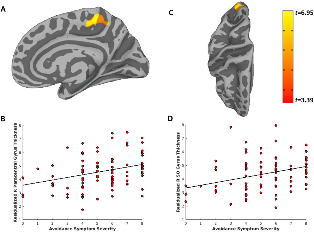 Differential relationships of PTSD symptom clusters with cortical thickness  and grey matter volumes among women with PTSD | Scientific Reports