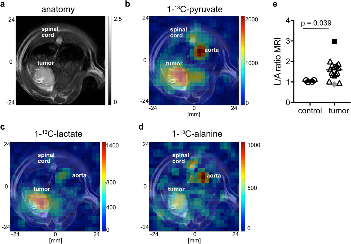 Hyperpolarized 13C pyruvate magnetic resonance spectroscopy for in vivo  metabolic phenotyping of rat HCC | Scientific Reports