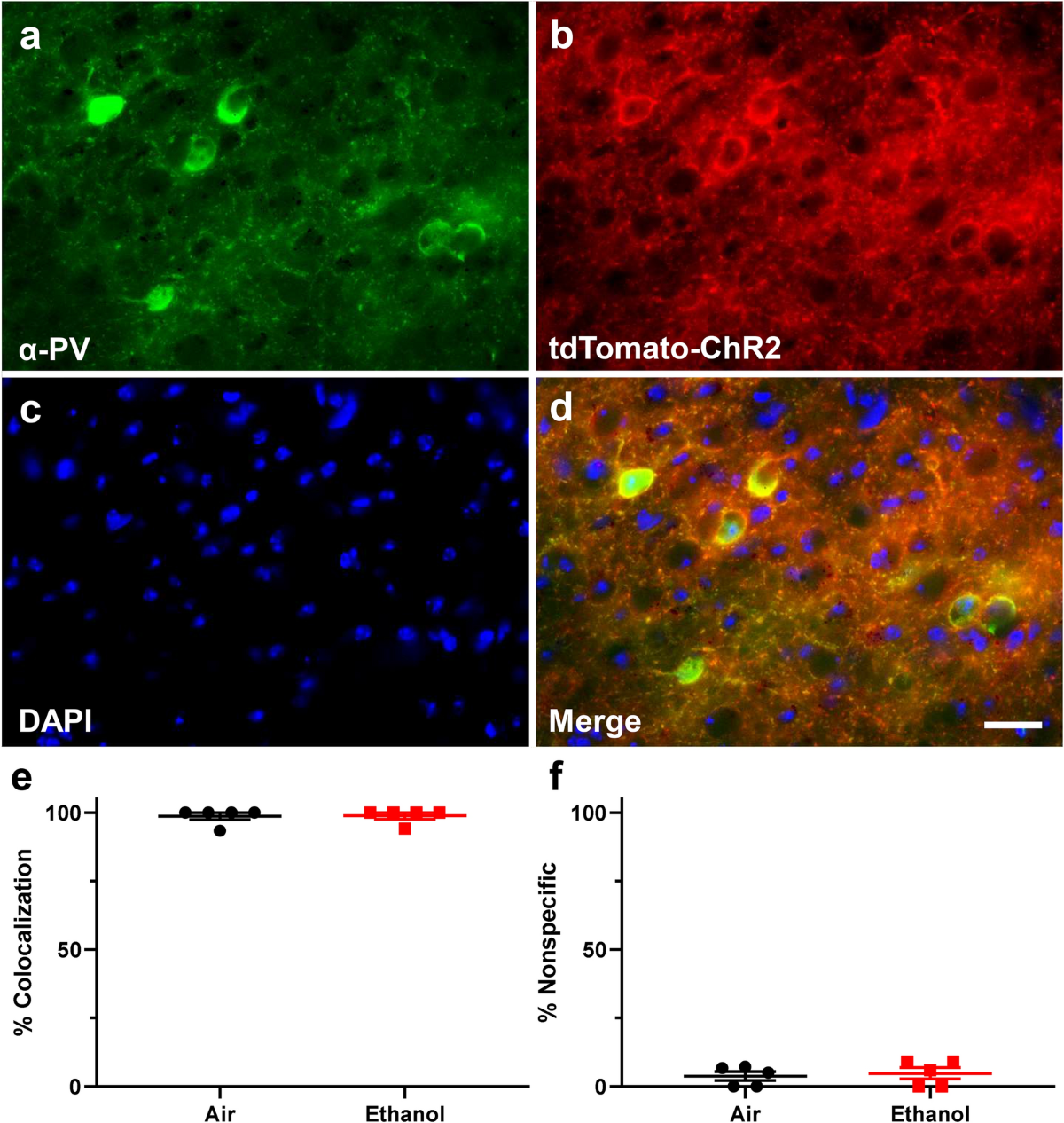 Enhancement of parvalbumin interneuron-mediated neurotransmission in the  retrosplenial cortex of adolescent mice following third  trimester-equivalent ethanol exposure | Scientific Reports