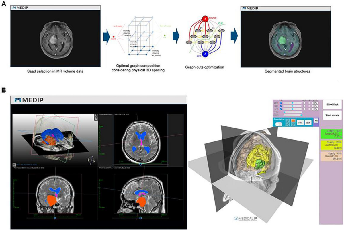 https://media.springernature.com/lw1200/springer-static/image/art%3A10.1038%2Fs41598-021-86546-y/MediaObjects/41598_2021_86546_Fig1_HTML.png
