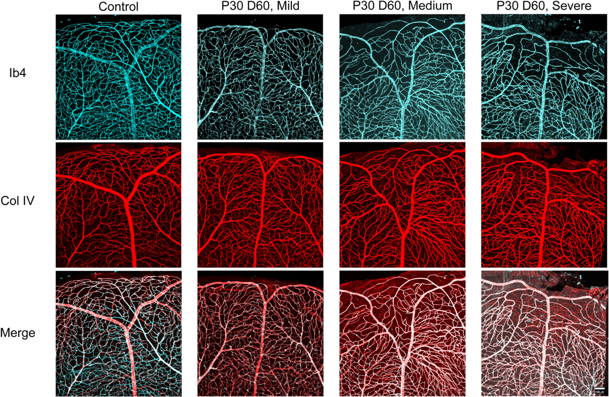 Hypoxic–ischemic injury causes functional and structural neurovascular  degeneration in the juvenile mouse retina | Scientific Reports