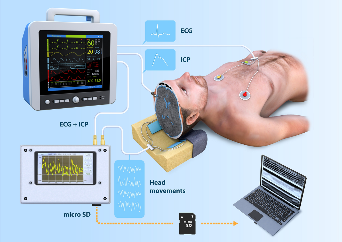 From head micro-motions towards CSF dynamics and non-invasive intracranial  pressure monitoring | Scientific Reports