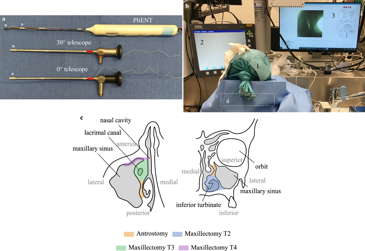 A miniature robotic steerable endoscope for maxillary sinus surgery called  PliENT | Scientific Reports