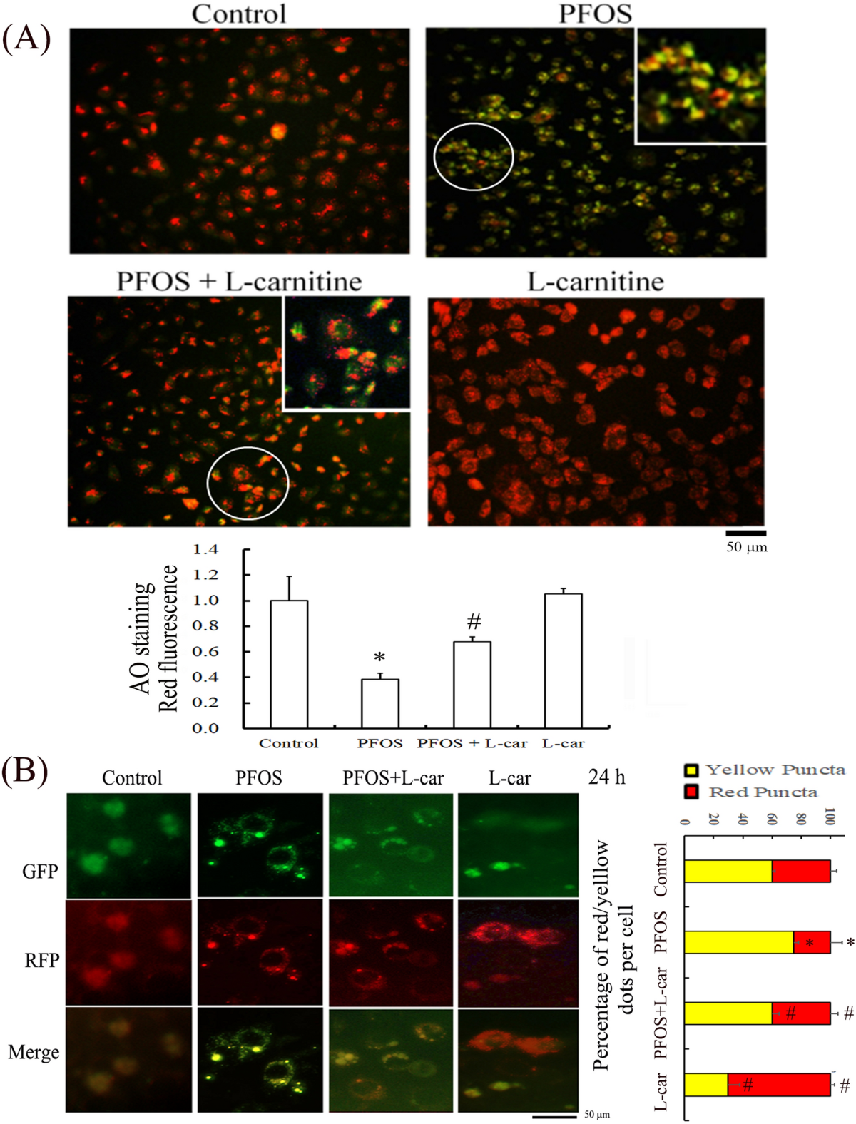 l-carnitine dramatic results for treating hyperthyroidism l-Carnitine reduces reactive oxygen species/endoplasmic reticulum stress  and maintains mitochondrial function during autophagy-mediated cell  apoptosis in perfluorooctanesulfonate-treated renal tubular cells