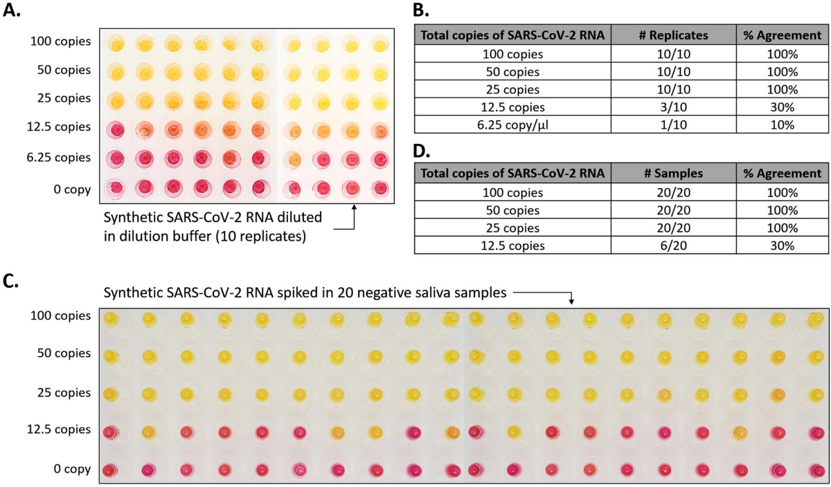 SaliVISION: a rapid saliva-based COVID-19 screening and diagnostic test  with high sensitivity and specificity | Scientific Reports