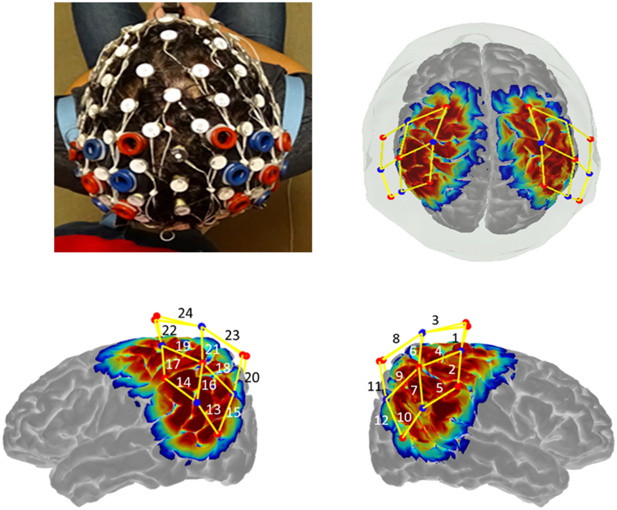 Structured sparse multiset canonical correlation analysis of simultaneous  fNIRS and EEG provides new insights into the human action-observation  network | Scientific Reports