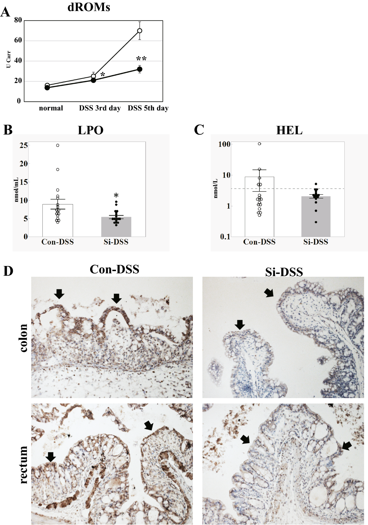 A new therapy against ulcerative colitis via the intestine and brain using  the Si-based agent