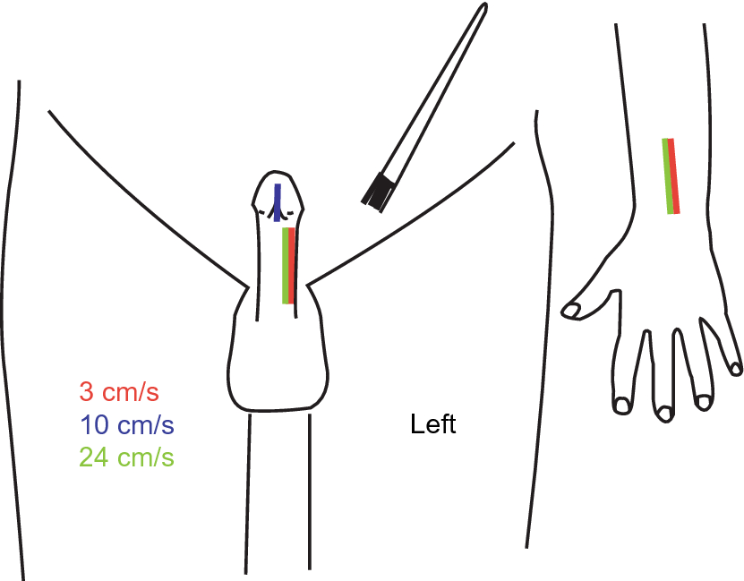 A psychophysical and neuroimaging analysis of genital hedonic sensation in men | Scientific Reports A psychophysical and neuroimaging analysis of genital hedonic sensation in men | Scientific Reports