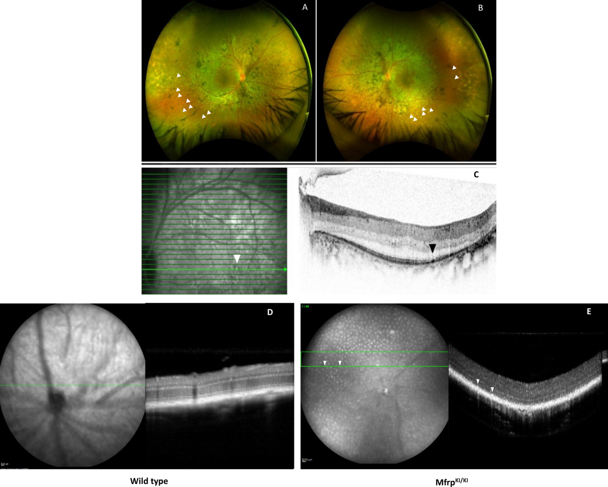 Single cell RNA sequencing confirms retinal microglia activation