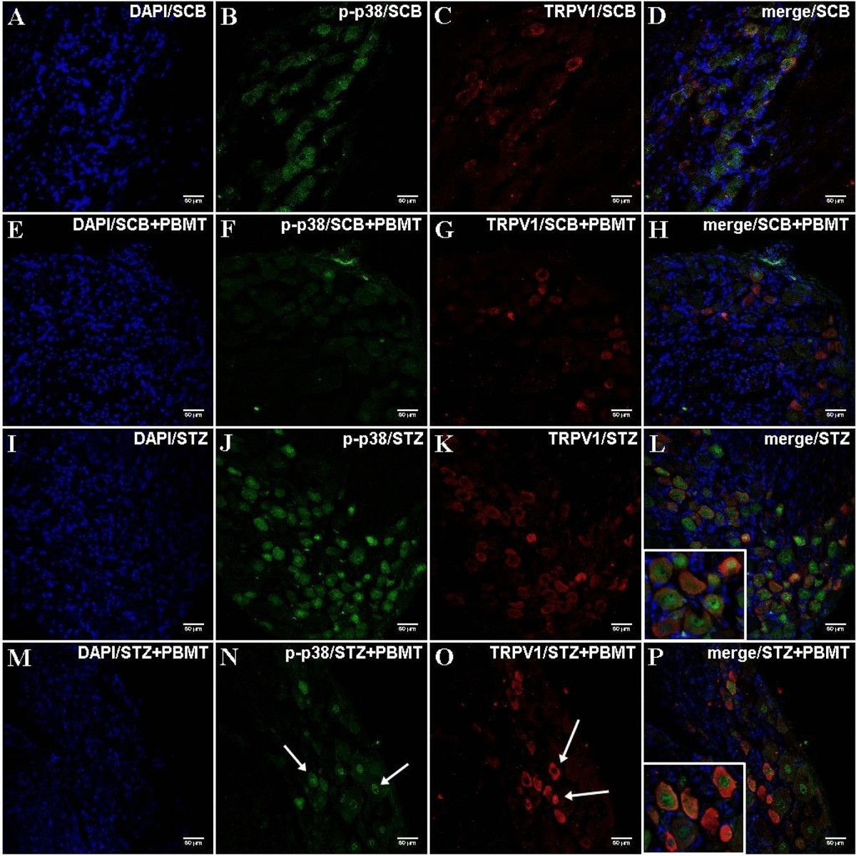 Anti-hyperalgesic effects of photobiomodulation therapy (904 nm) on  streptozotocin-induced diabetic neuropathy imply MAPK pathway and calcium  dynamics modulation | Scientific Reports