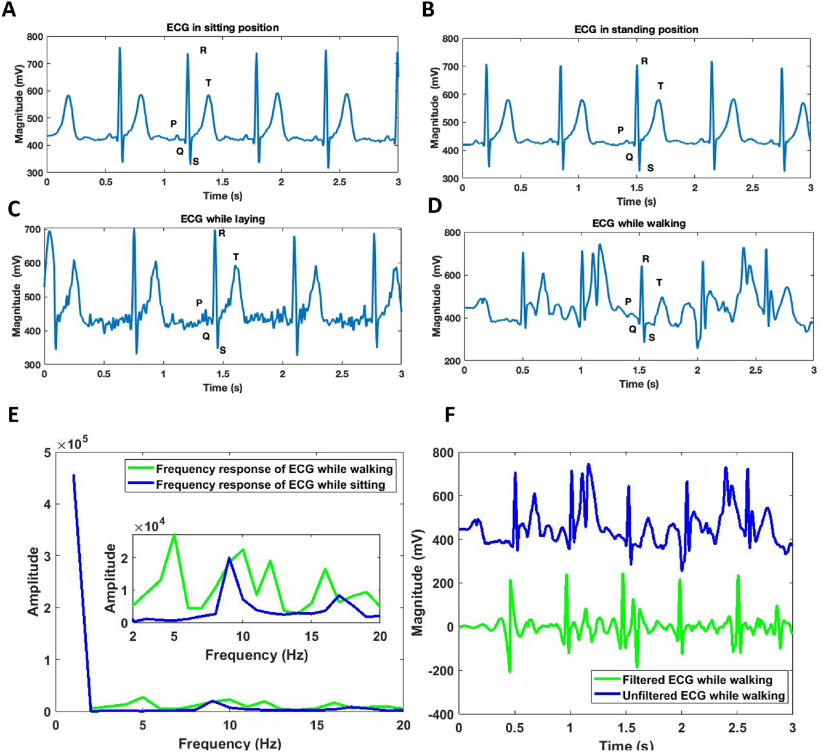 Belt with sensors monitors heart parameters 24/7 - Today's Medical