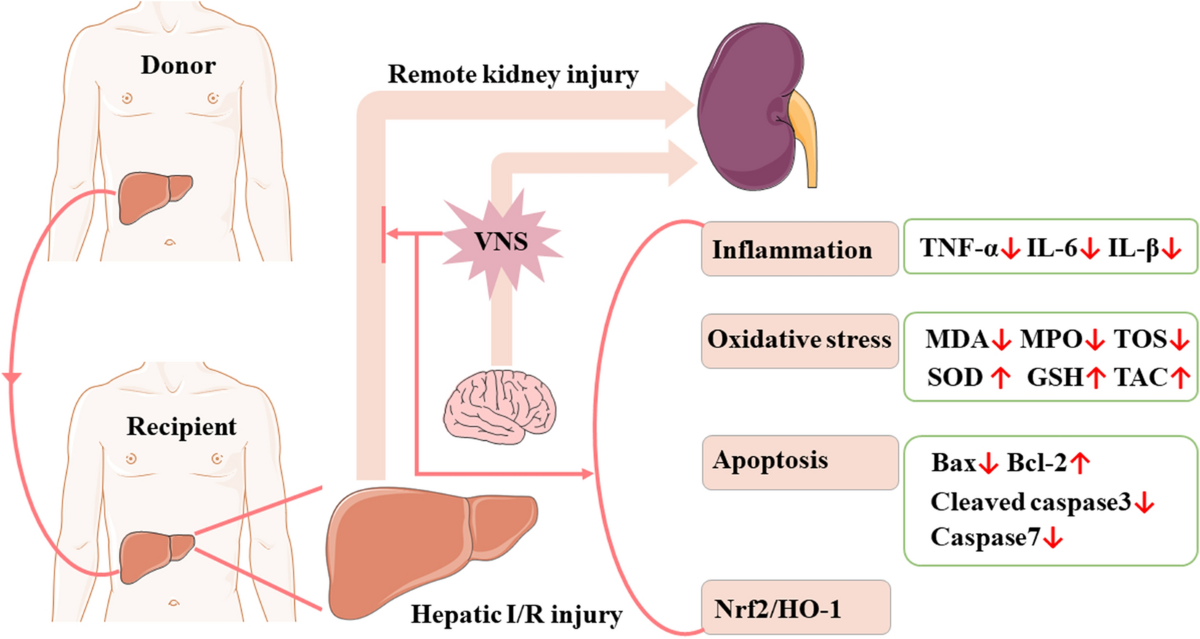 glutathione peroxidase in schizophrenia Glutathione peroxidase-1 and neuromodulation: Novel potentials of an old  enzyme