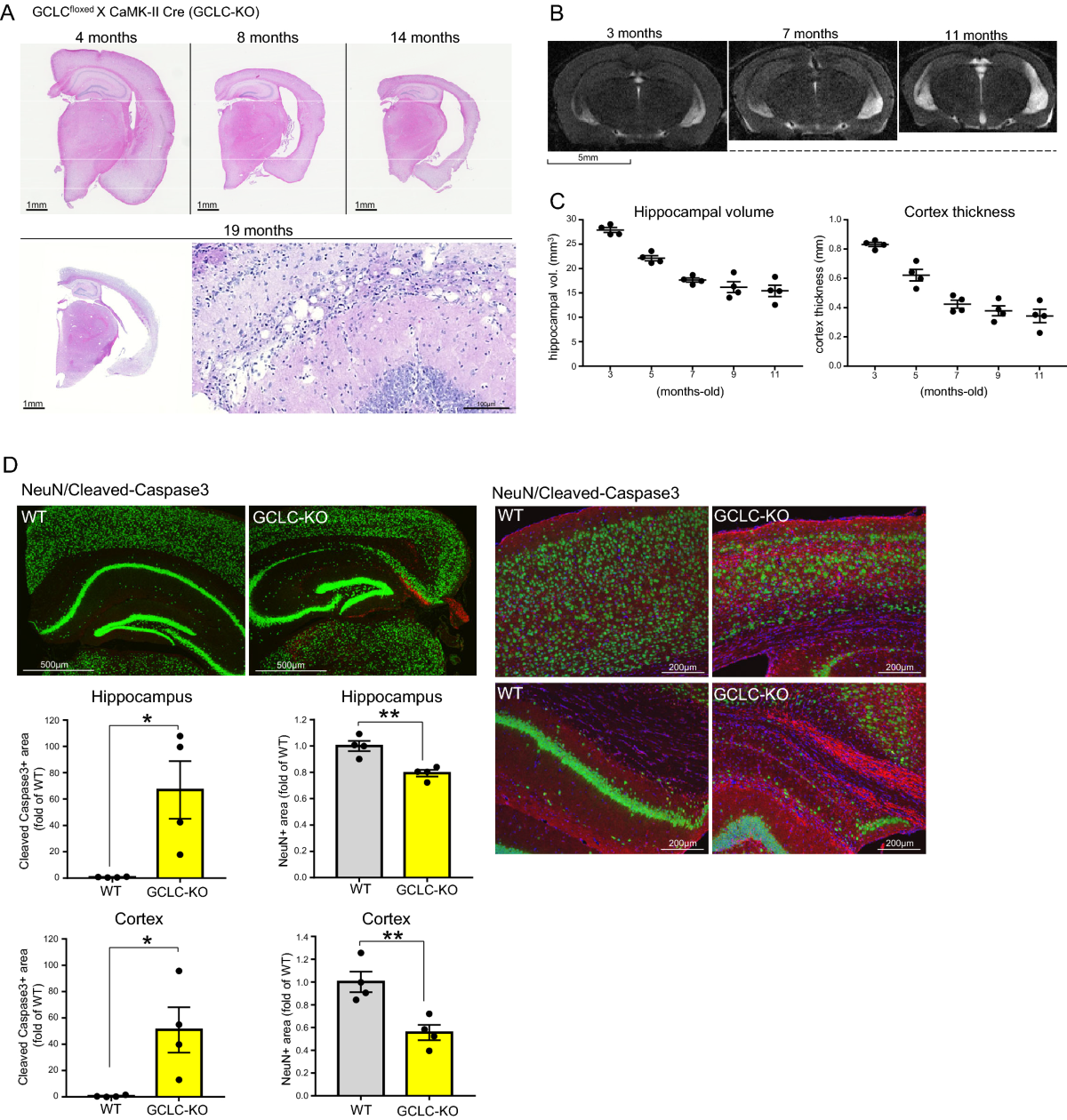 Neuronal glutathione loss leads to neurodegeneration involving gasdermin  activation