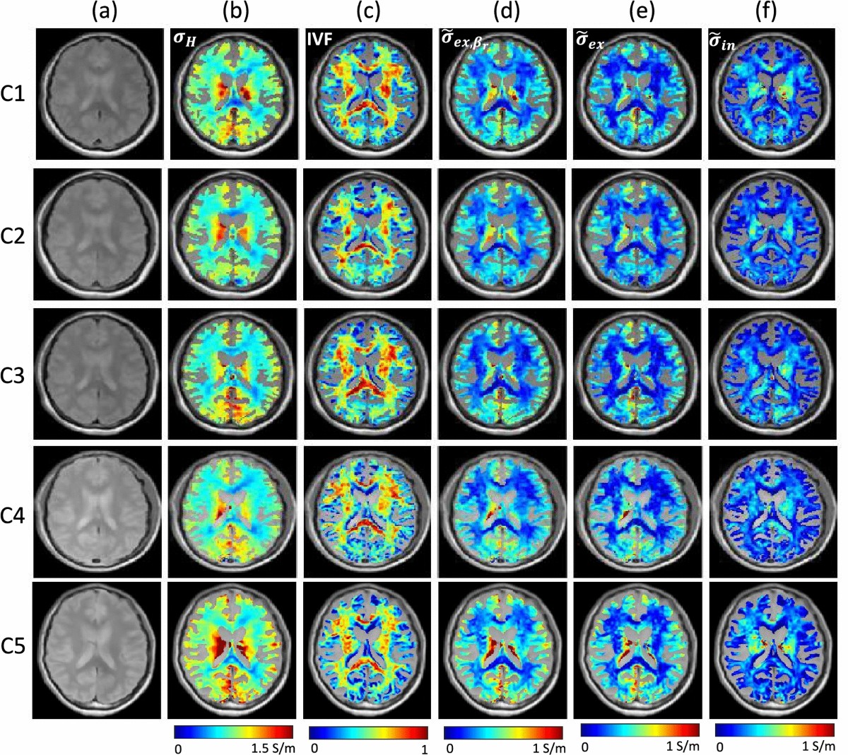 High frequency conductivity decomposition by solving physically 