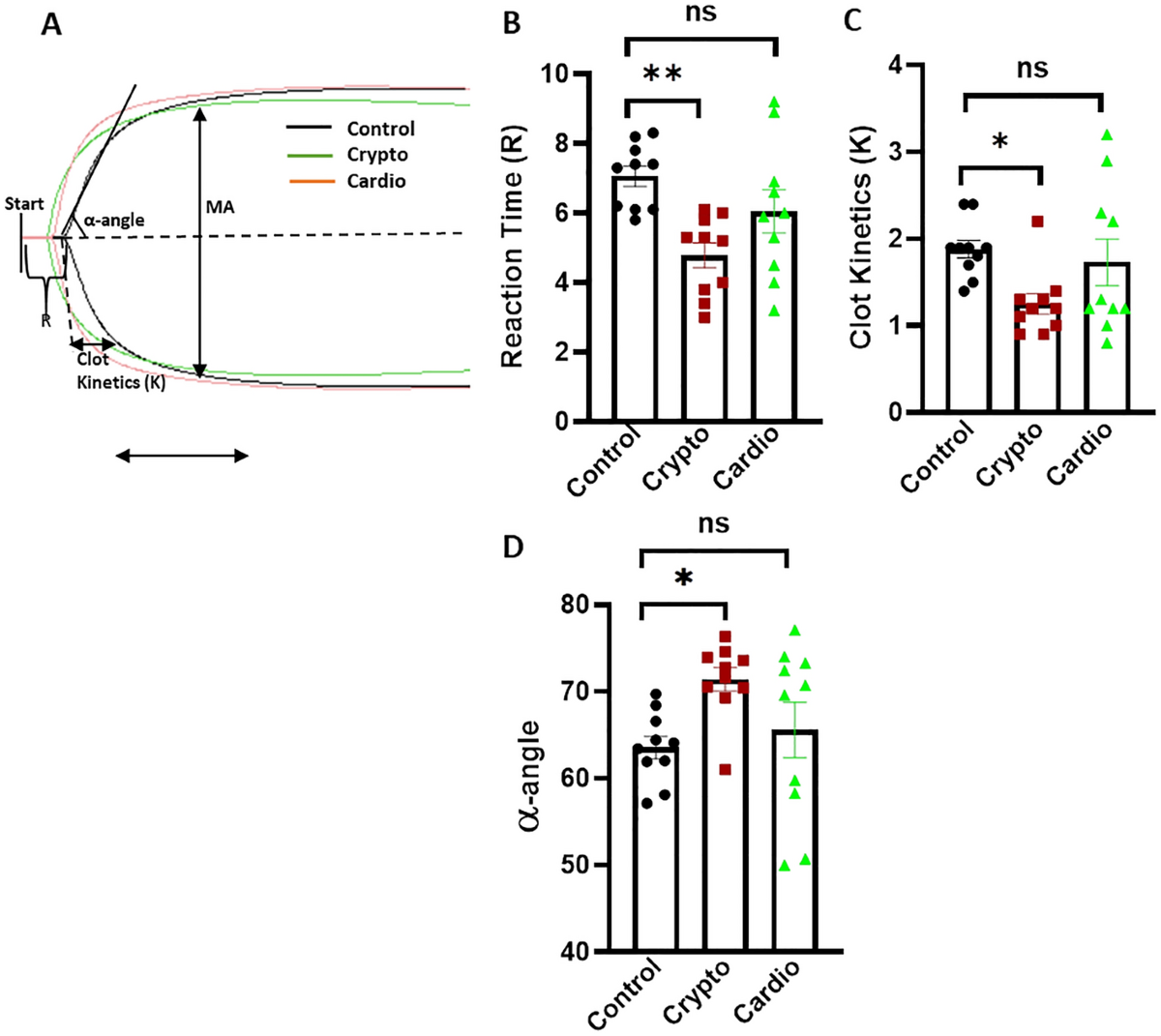 Platelet function suggests cardioembolic aetiology in cryptogenic stroke |  Scientific Reports