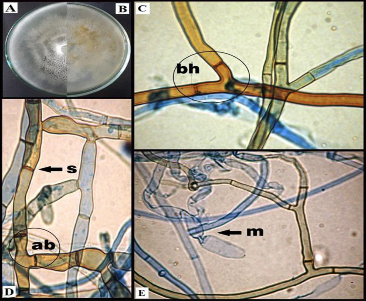 Characterization and control of Rhizoctonia solani affecting lucky bamboo  (Dracaena sanderiana hort. ex. Mast.) using some bioagents | Scientific  Reports