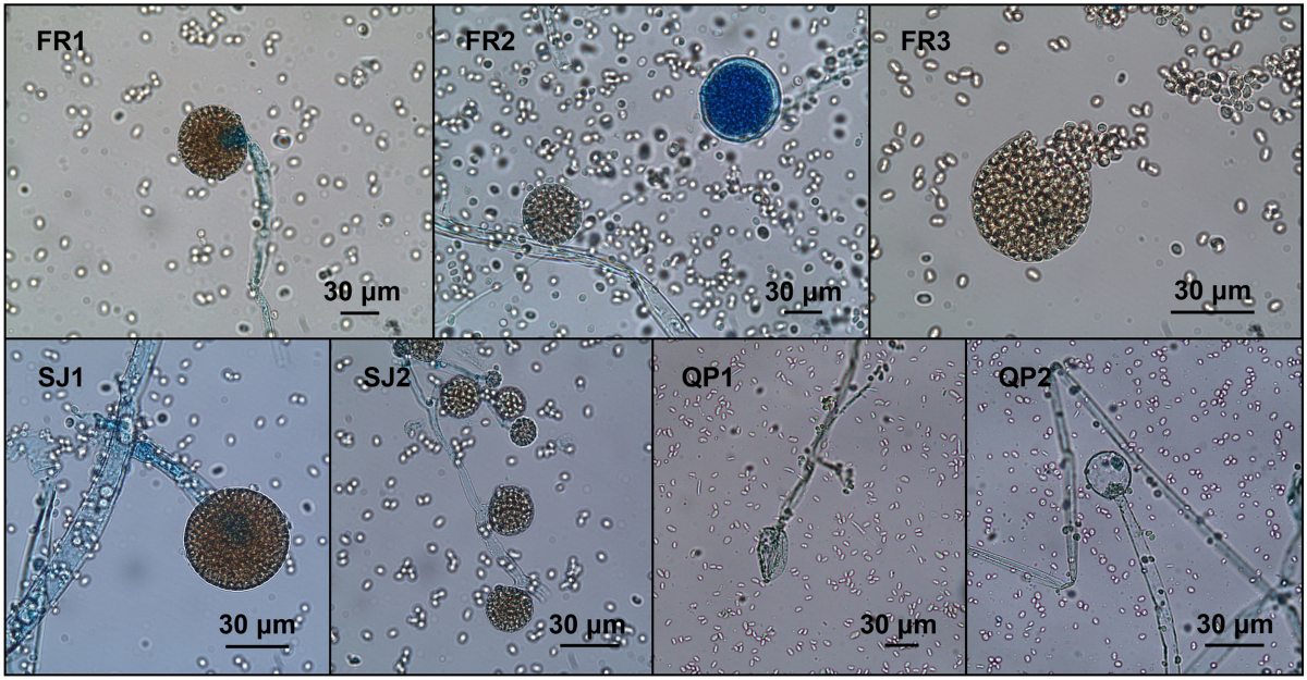 https://media.springernature.com/lw1200/springer-static/image/art%3A10.1038%2Fs41598-023-36120-5/MediaObjects/41598_2023_36120_Fig1_HTML.png