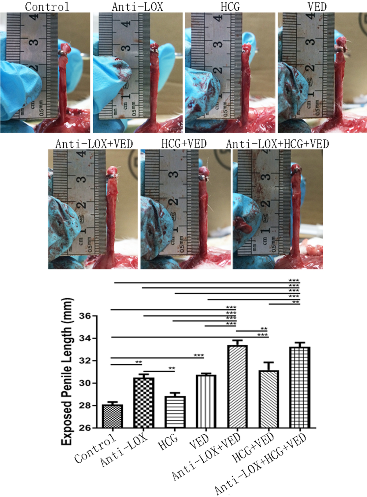Penis puberty size HCG supplement did not accelerate tunica albuginea remodeling to facilitate penile  growth | Scientific Reports