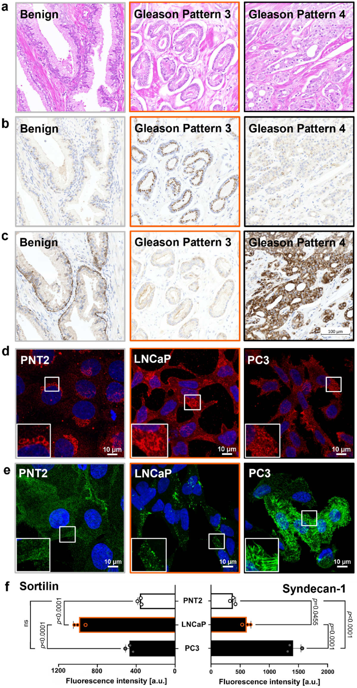pimpandhost uploaded on 2016 " PM a 1 1