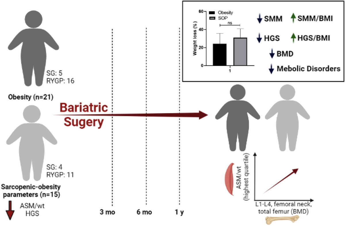 Bariatric surgery outcomesSarcopenia study graphFemale health research