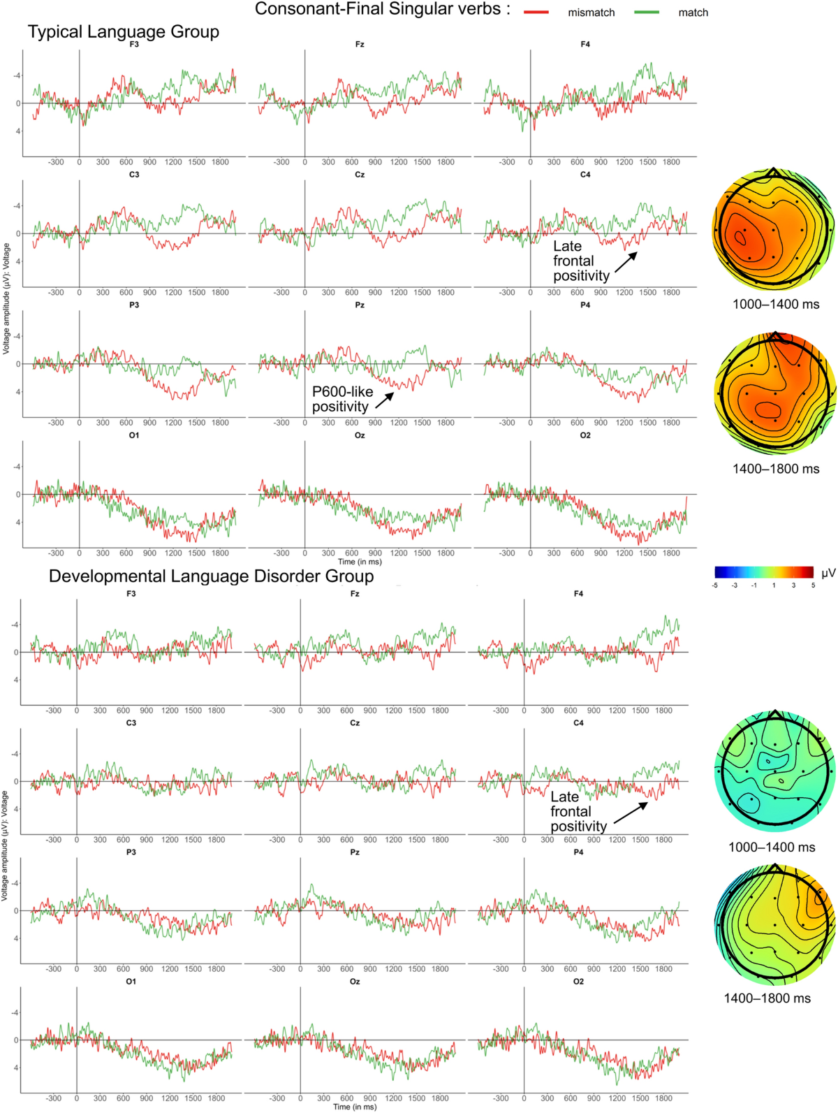 Preteens nudel mode Number agreement processing in adolescents with and without developmental  language disorder (DLD): evidence from event-related brain potentials |  Scientific Reports
