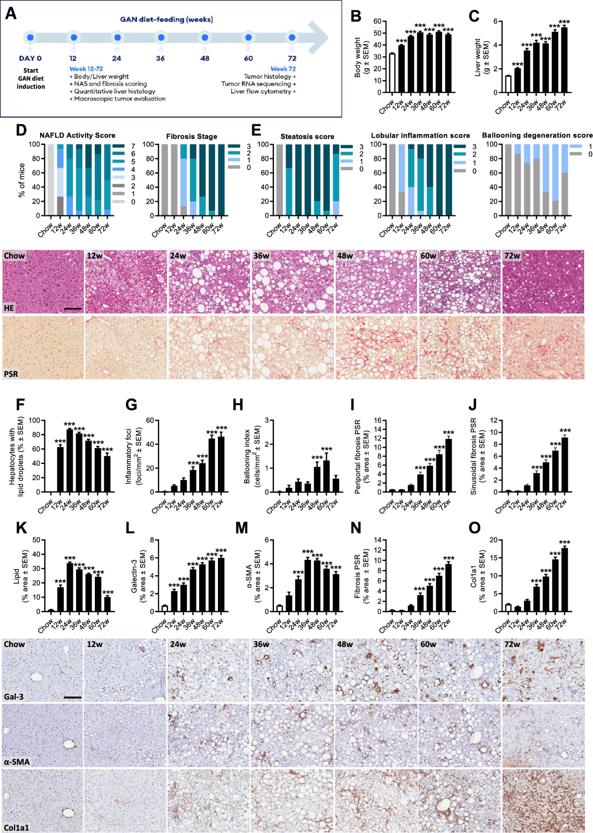 semaglutide and tumors Research Reveals Potential Risks of Popular GLP-1 Medications for Some with Neuroendocrine Cancer GLP-1s appear to cut cancer