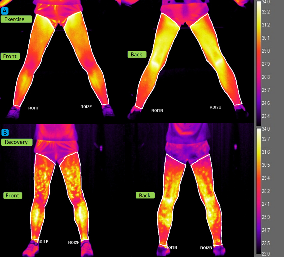graph of physiological response to exercise