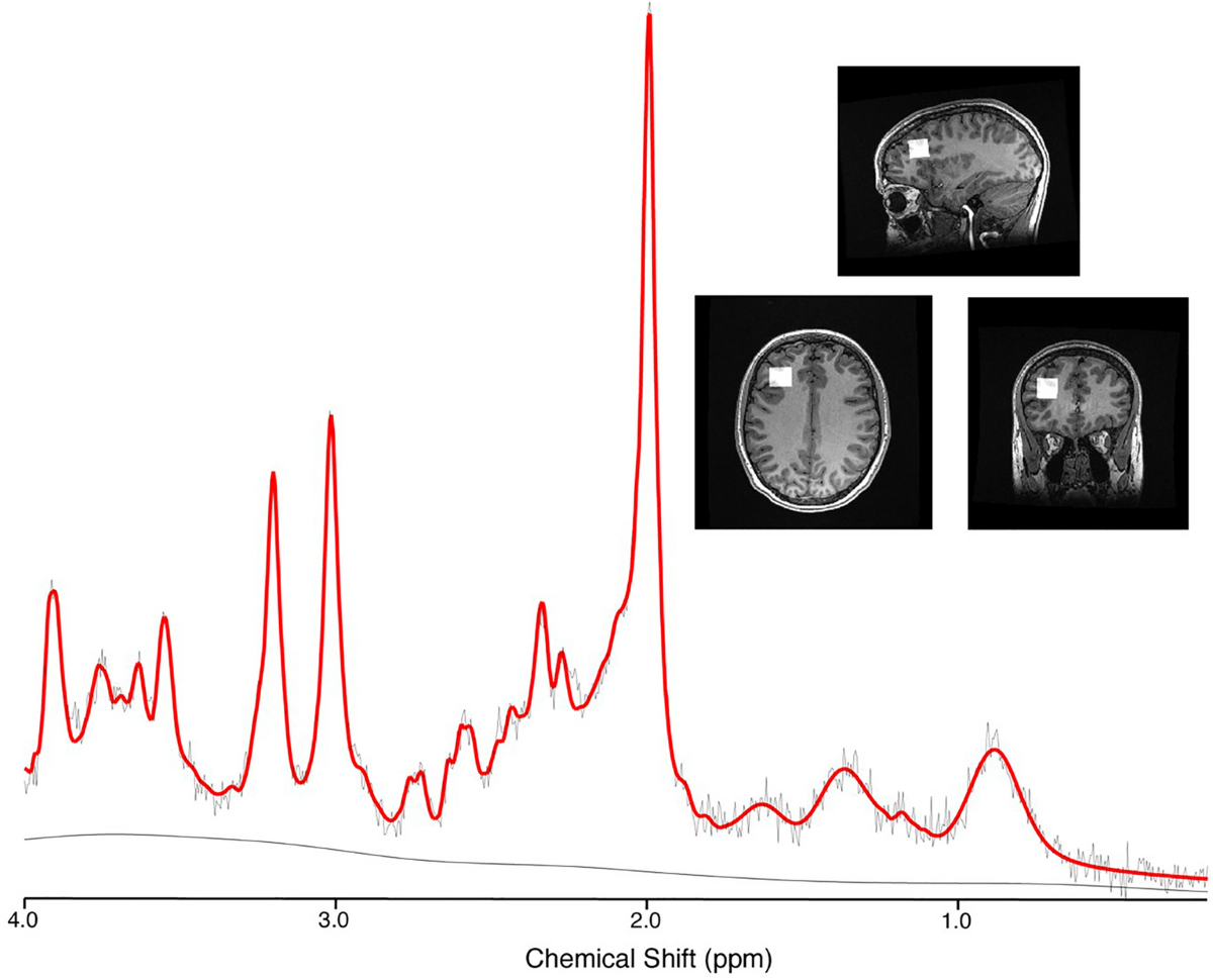 glutathione concussion Glutathione main image 1