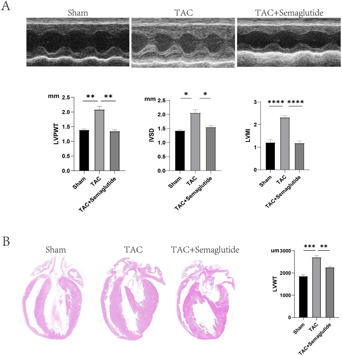 heart palpitations semaglutide Semaglutide ameliorates pressure overload-induced cardiac hypertrophy by  improving cardiac mitophagy to suppress the activation of NLRP3  inflammasome