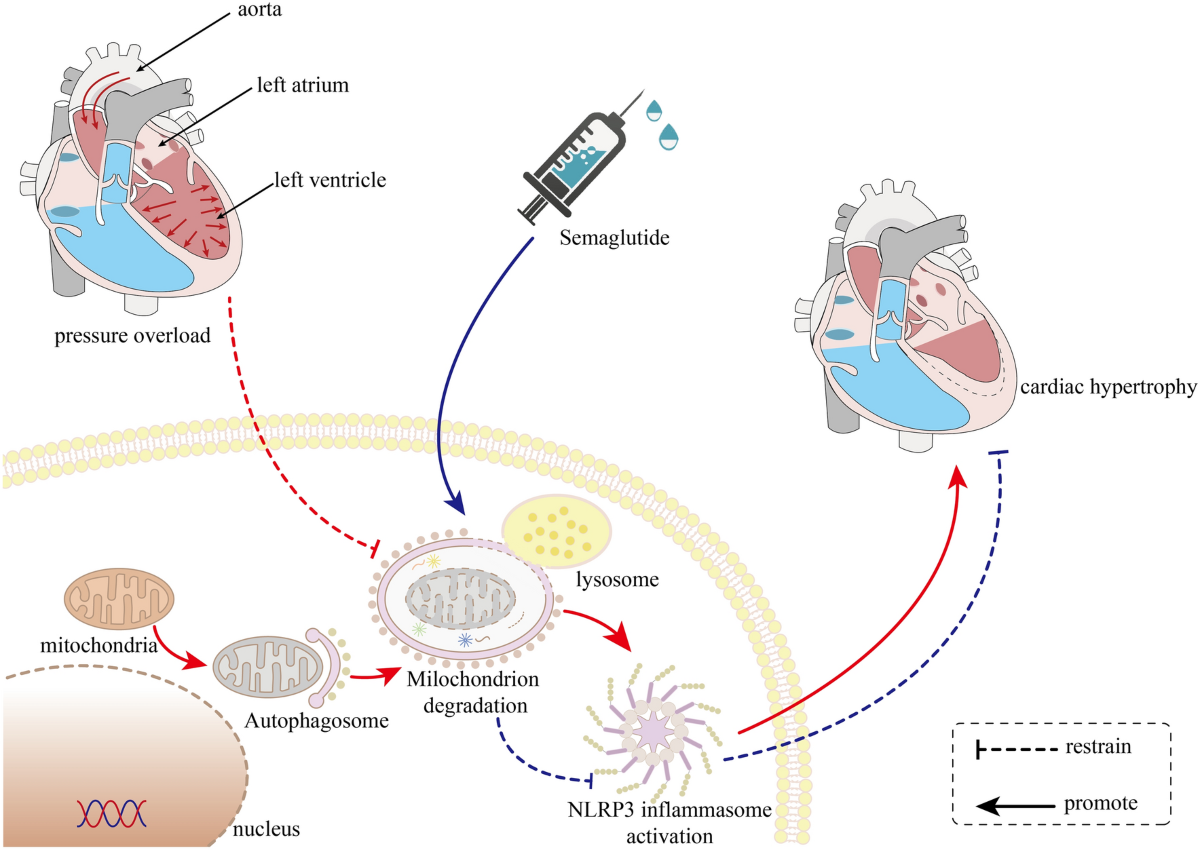 semaglutide and heart palpitations Semaglutide ameliorates pressure overload-induced cardiac hypertrophy by  improving cardiac mitophagy to suppress the activation of NLRP3  inflammasome