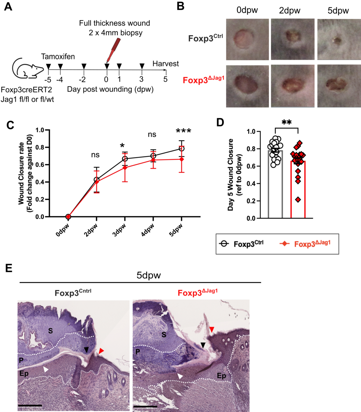 Jagged-1+ skin Tregs modulate cutaneous wound healing | Scientific Reports