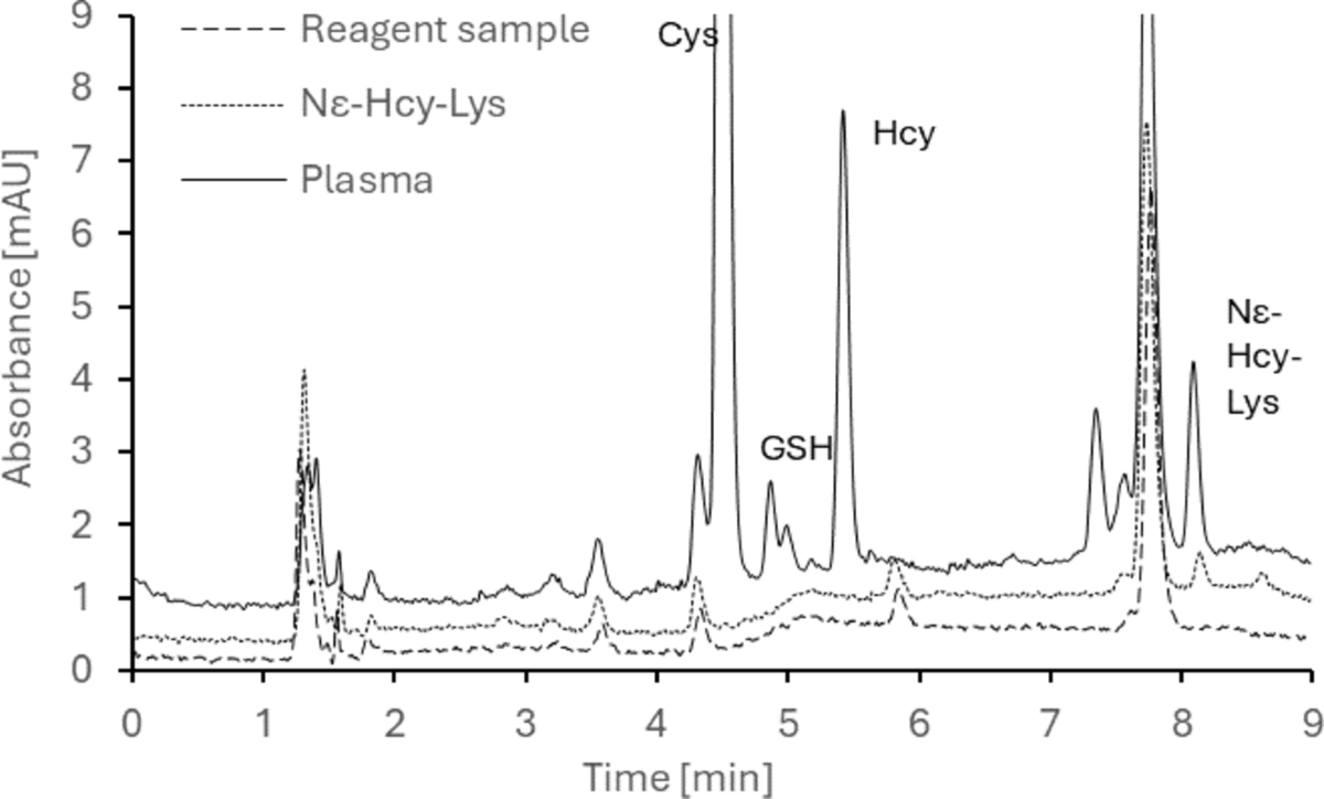 glutathione hplc A new chromatographic method for the determination of cysteine, glutathione,  homocysteine and Nɛ-homocysteinyllysine isopeptide in human plasma