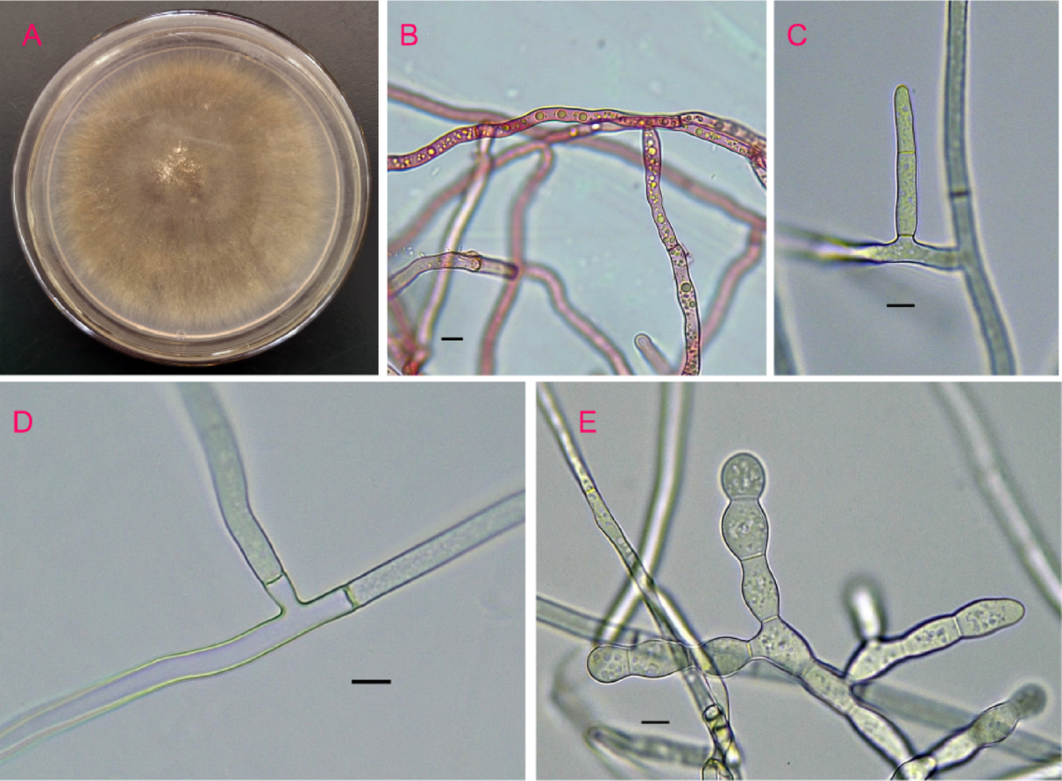 Rhizoctonia solani causes okra (Abelmoschus esculentus) seedling  damping-off in South China with biological characterization and fungicide  sensitivity profiling | Scientific Reports