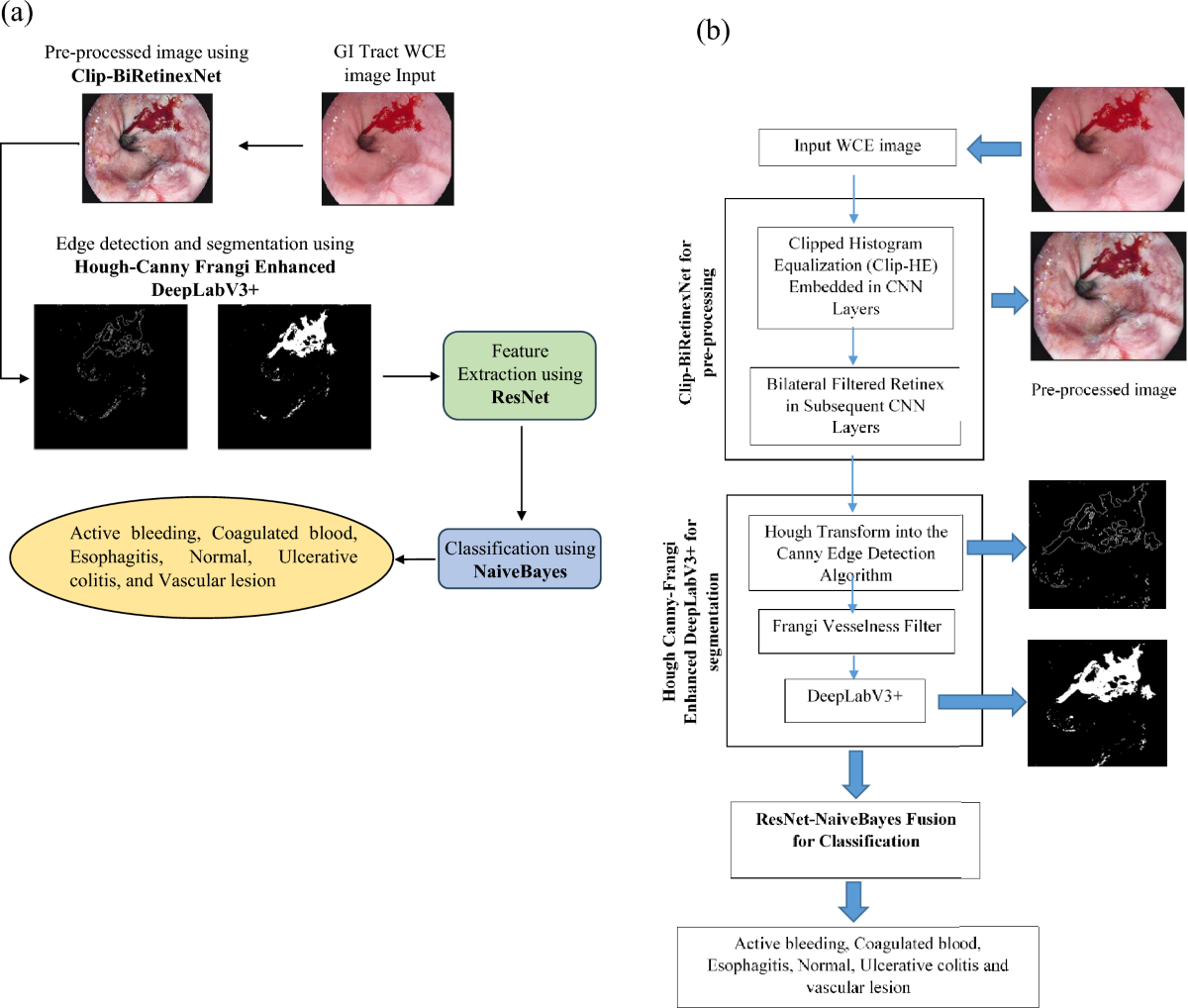 Multi-stage convo-enhanced retinex canny DeepLabv3+ FusionNet for enhanced  detection and classification of bleeding regions in GI tract | Scientific  Reports