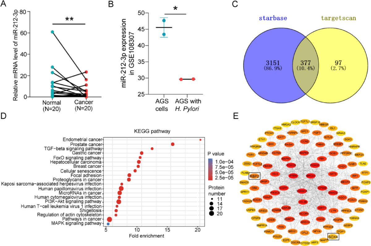 RBP2 promotes gastric cancer cell migration by acting as a competitive  endogenous RNA to upregulate SOX4 via sponging miR-212-3p | Scientific  Reports