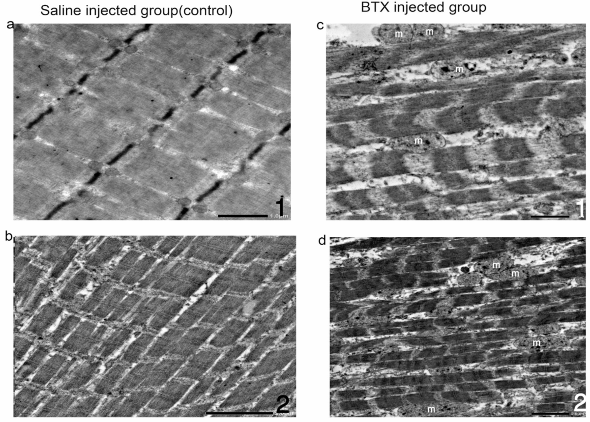 Effect of botulinum toxin type A on masticatory function and  musculoskeletal structure in rabbits | Scientific Reports