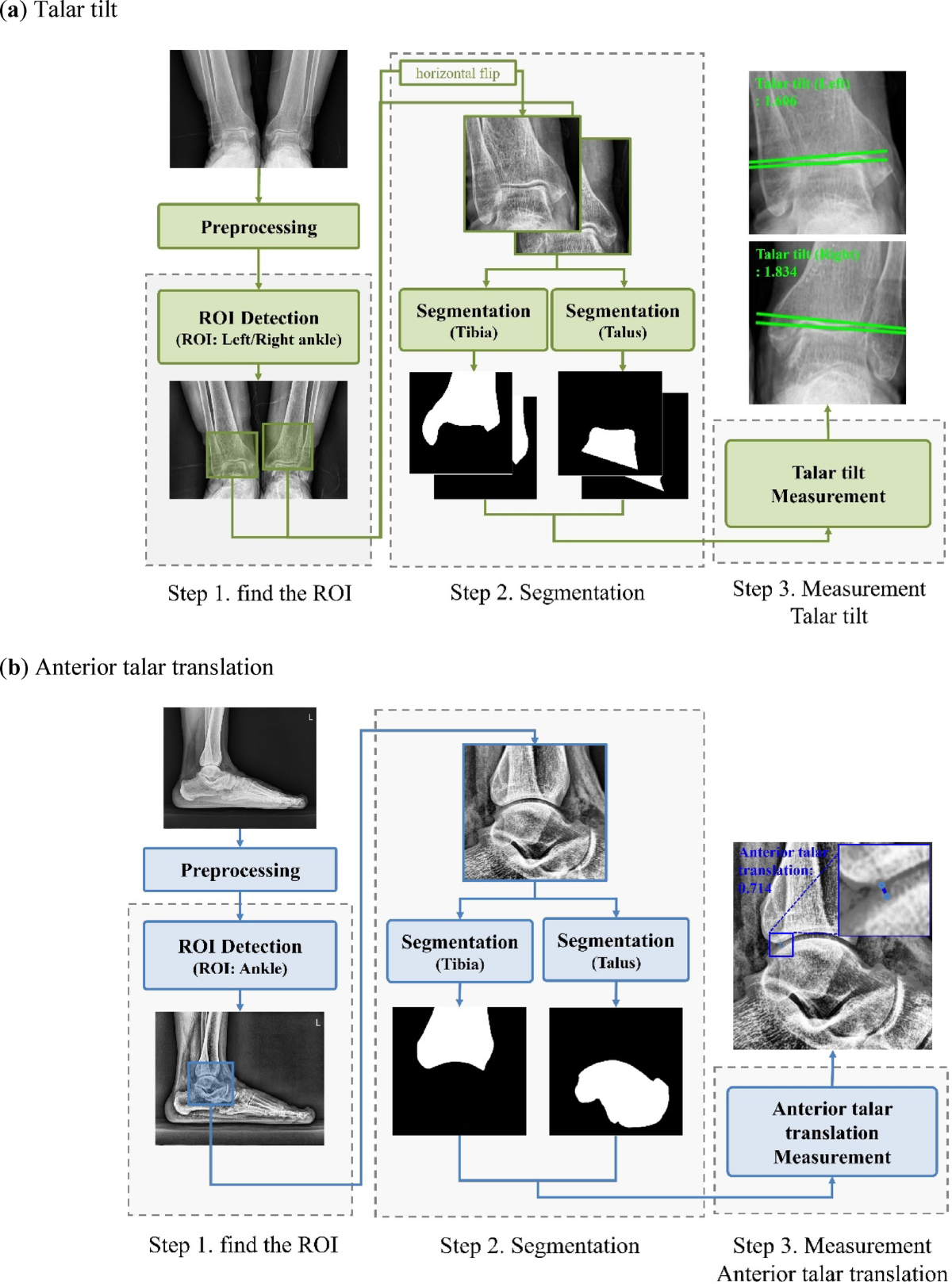 Automated radiography assessment of ankle joint instability using deep  learning | Scientific Reports