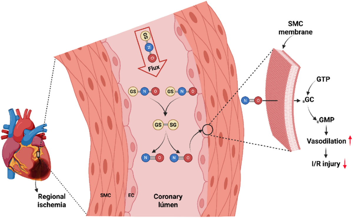 inhibition of human glutathione reductase by s nitrosoglutathione S-nitrosoglutathione preserves vasodilation and attenuates myocardial  ischemia-reperfusion injury