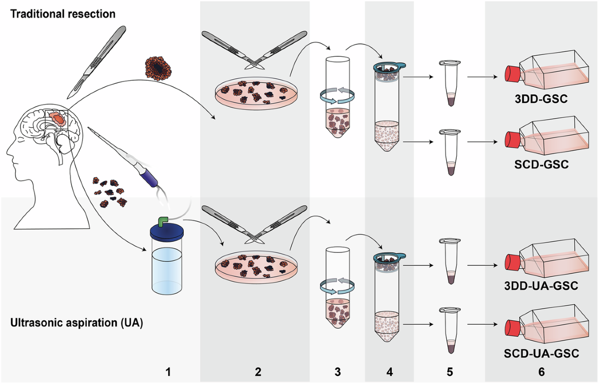 Optimized culturing yields high success rates and preserves molecular  heterogeneity, enabling personalized screening for high-grade gliomas | npj  Precision Oncology