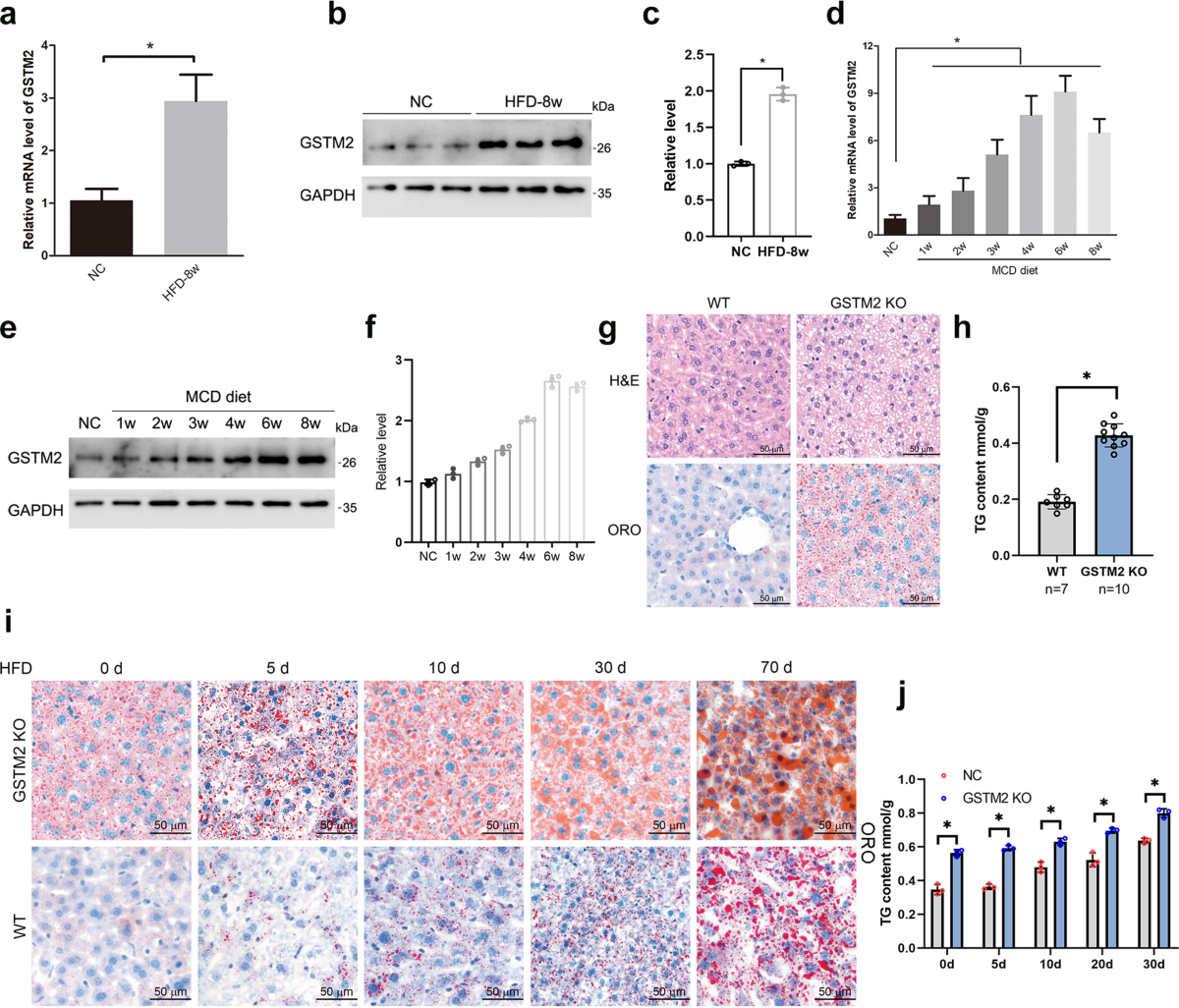 treat fatty liver glutathione Glutathione S-transferase Mu 2 inhibits hepatic steatosis via ASK1  suppression