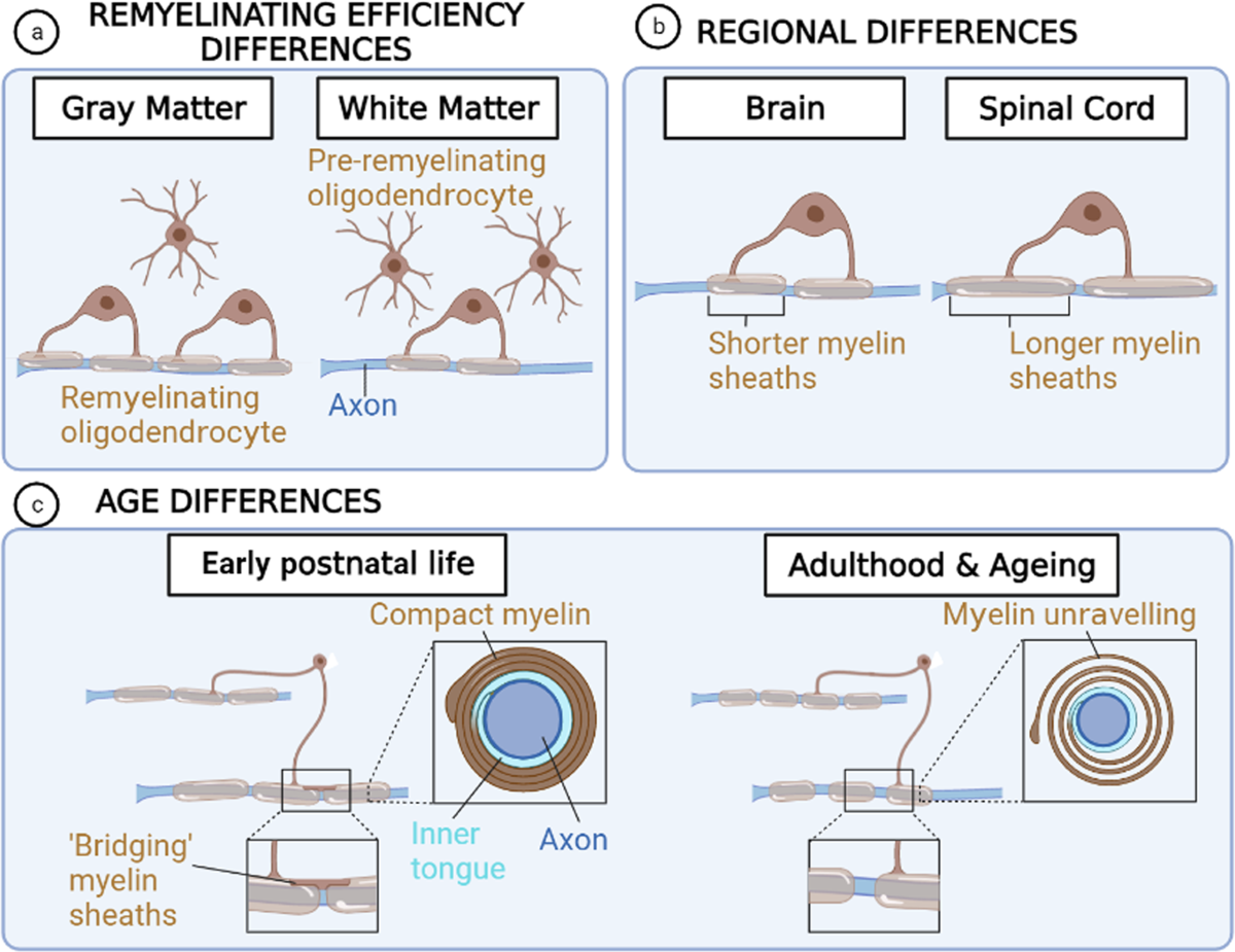 glutathione myelin sheath repair Chronic oligodendrocyte injury in central nervous system pathologies