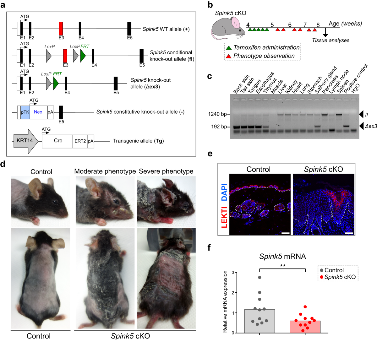 Comparative analyses of Netherton syndrome patients and Spink5 conditional  knock-out mice uncover disease-relevant pathways | Communications Biology