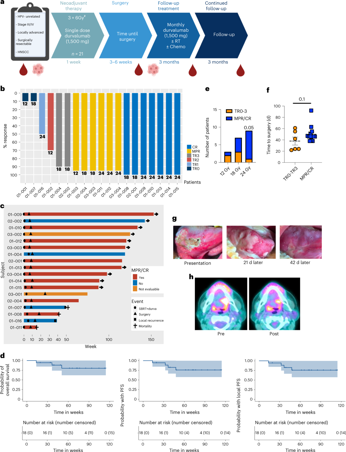 A phase I/Ib trial and biological correlate analysis of neoadjuvant SBRT  with single-dose durvalumab in HPV-unrelated locally advanced HNSCC |  Nature Cancer