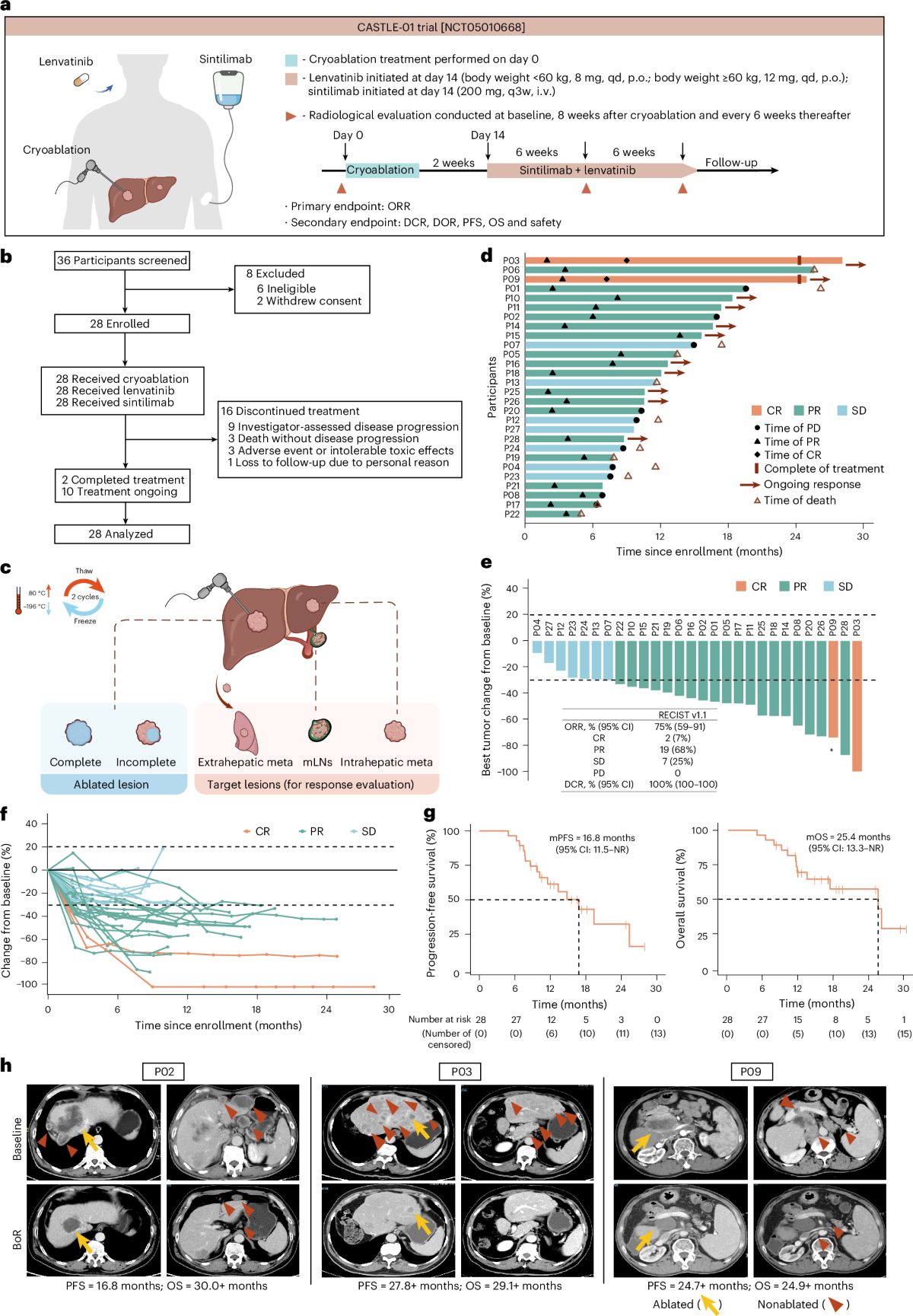 Cryoablation plus sintilimab and lenvatinib in advanced or metastatic  intrahepatic cholangiocarcinoma: a phase 2 trial | Nature Cancer