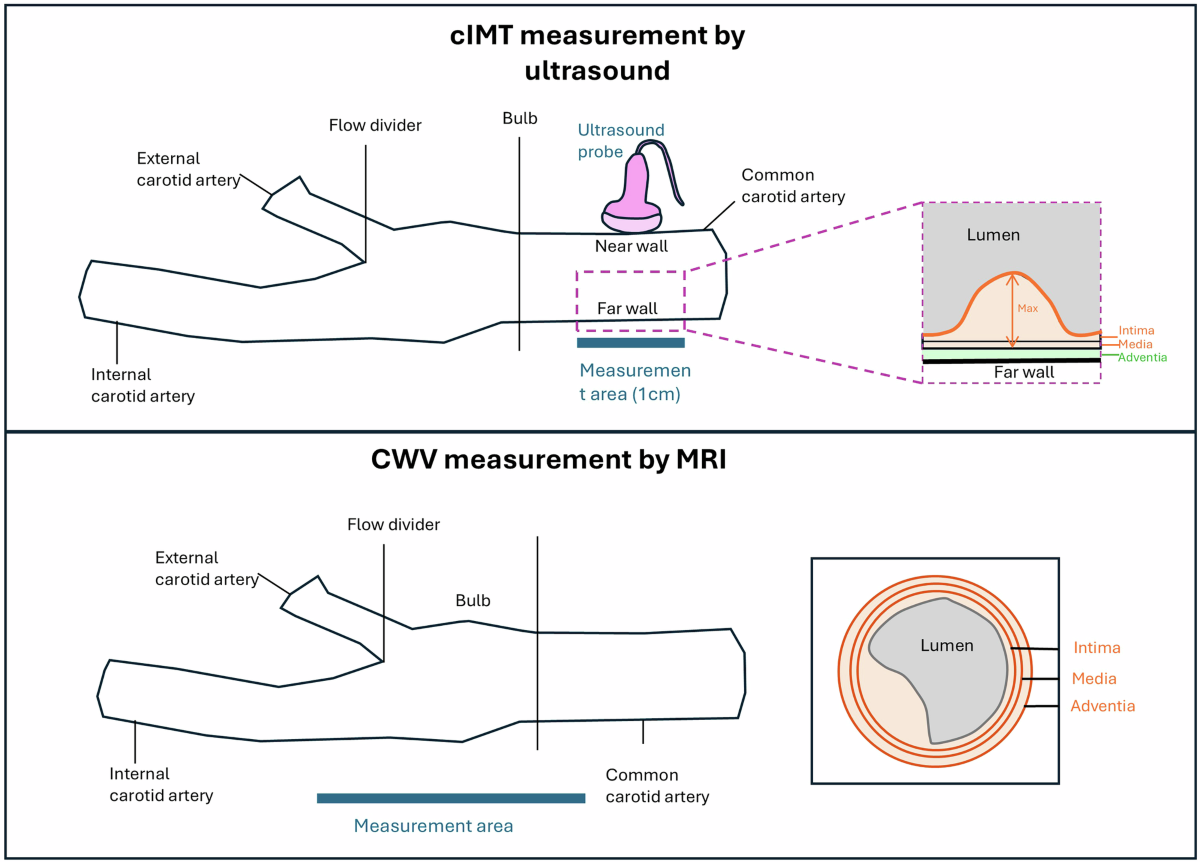 Visceral adipose tissue and hepatic fat as determinants of carotid  atherosclerosis | Communications Medicine