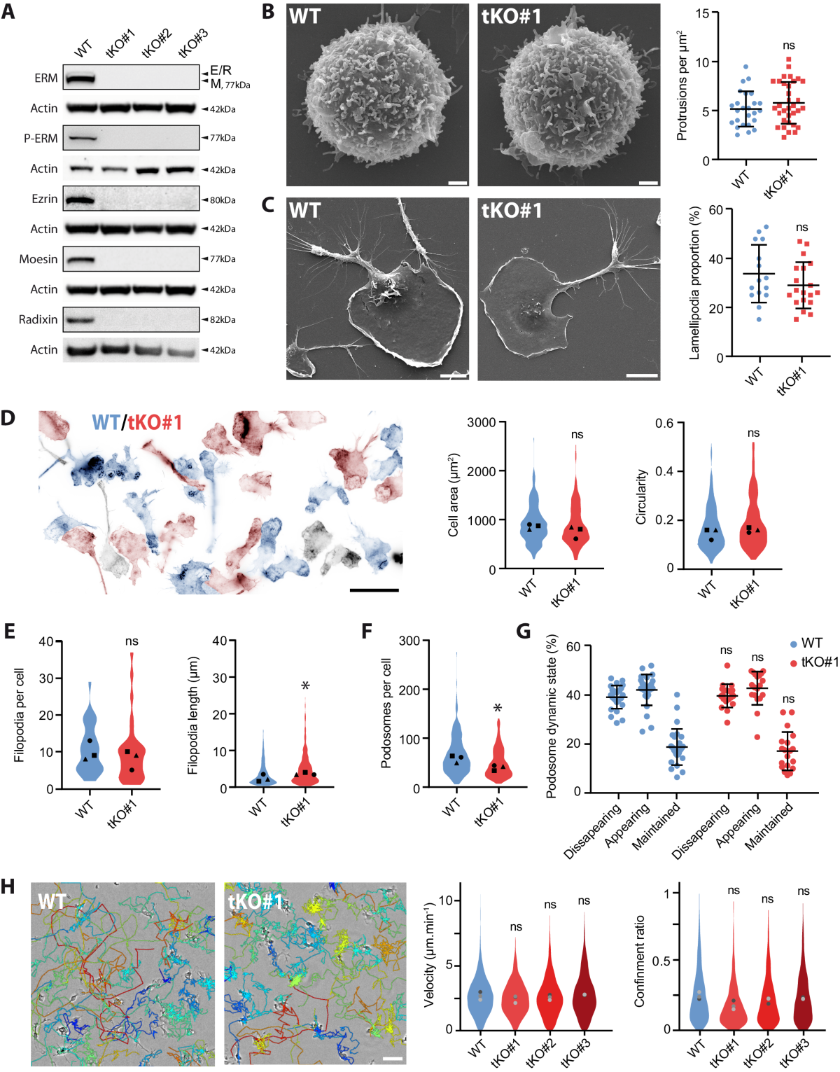 Ezrin, radixin, and moesin are dispensable for macrophage migration and  cellular cortex mechanics | The EMBO Journal | Springer Nature Link