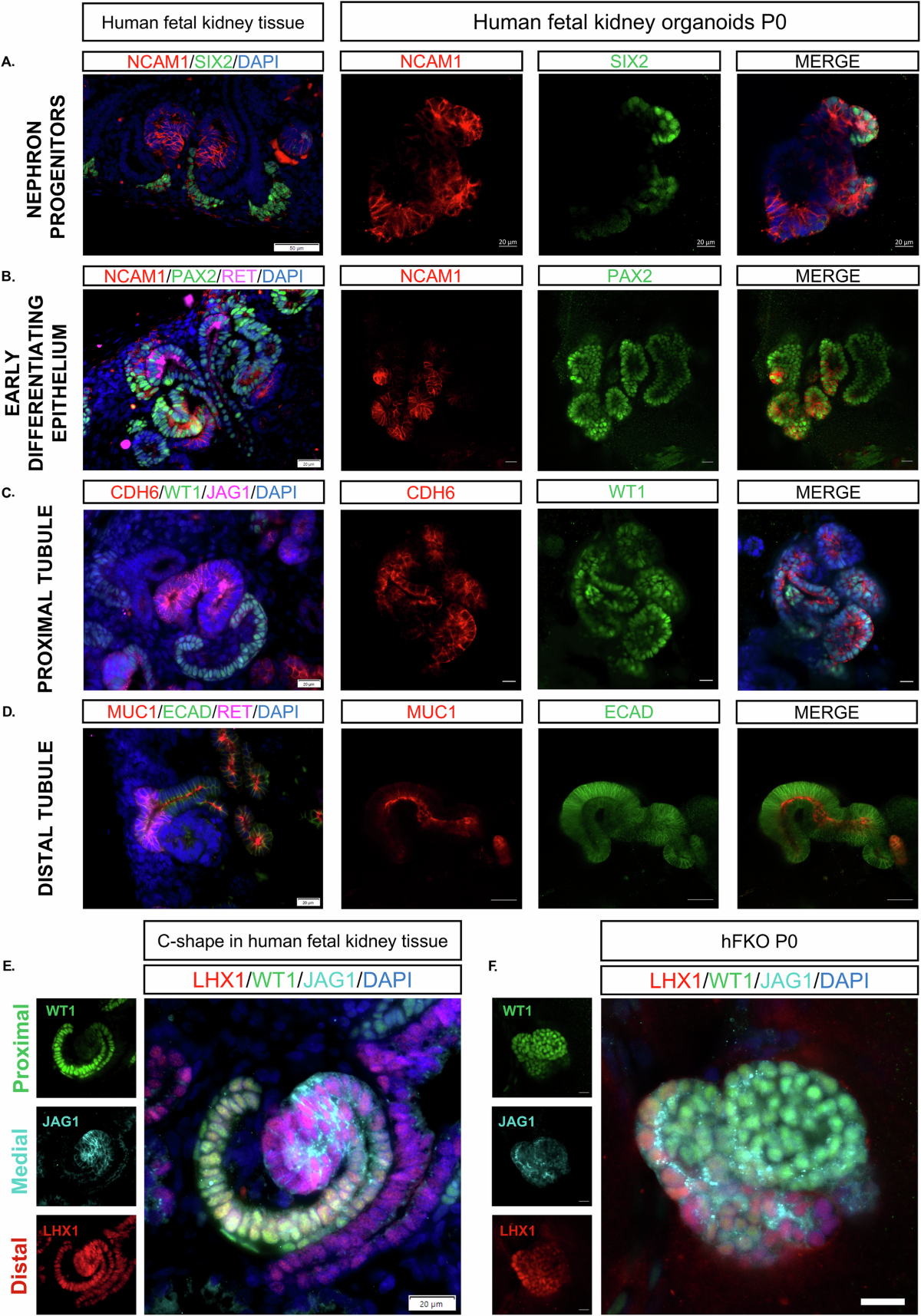 Human fetal kidney organoids model early human nephrogenesis and  Notch-driven cell fate | The EMBO Journal | Springer Nature Link